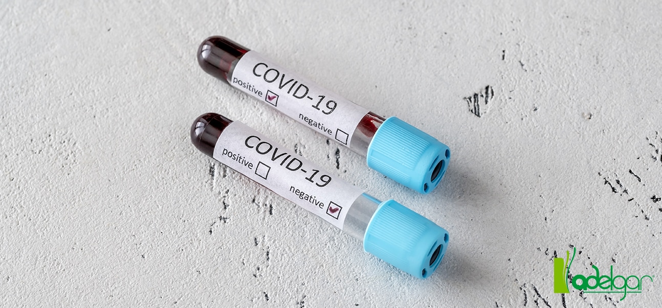 blog_comunicado_covid